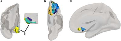 Neuroimaging Correlates of Suicidality in Decision-Making Circuits in Posttraumatic Stress Disorder